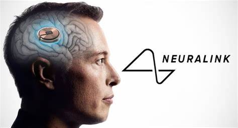 Neuralink necesita voluntarios